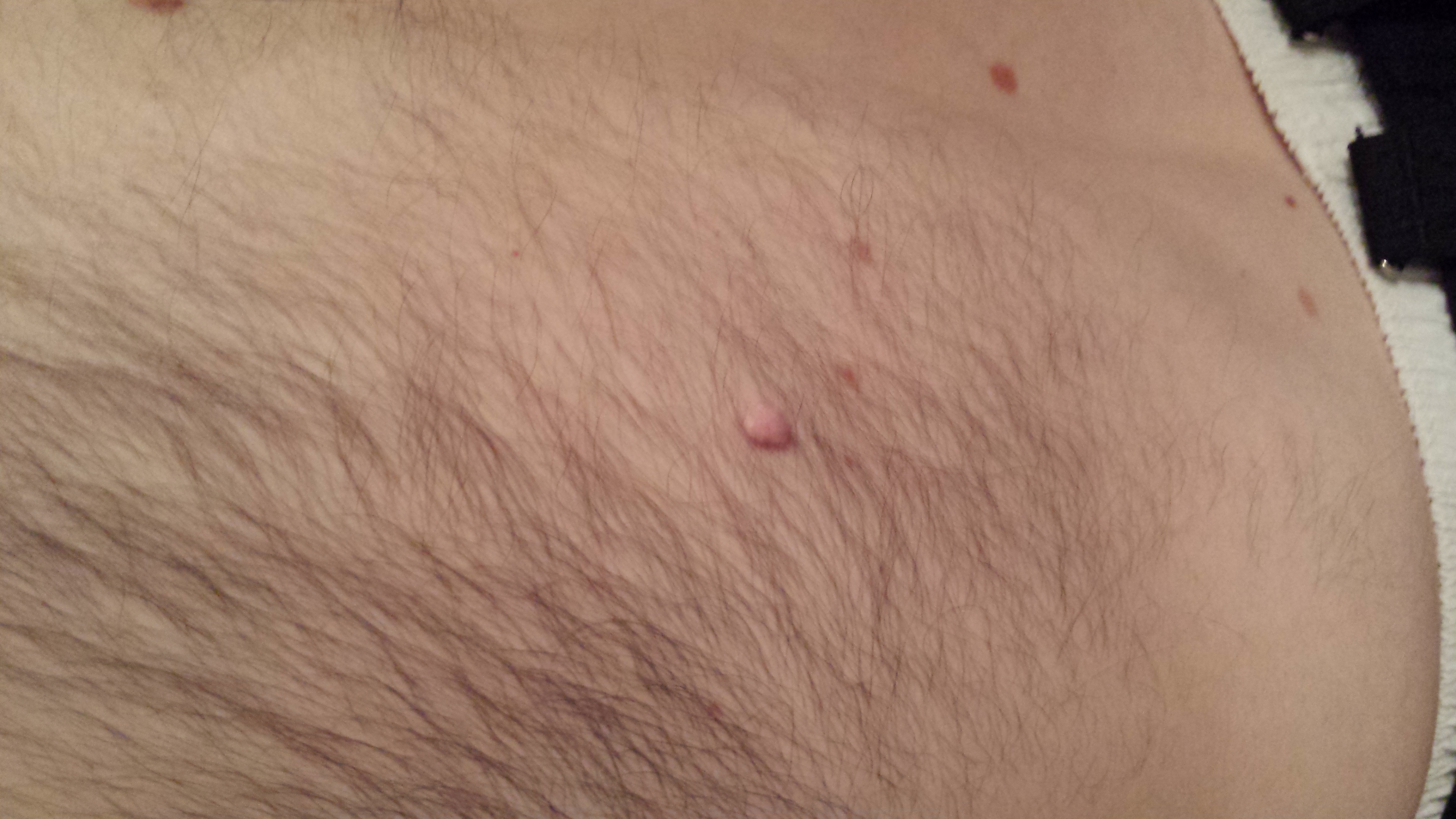 How lose weight in stomach picture 2